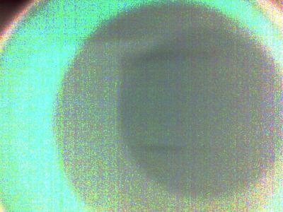 20070428123758-ache.jpg