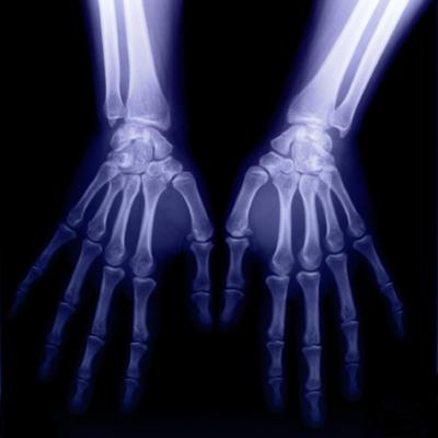 20080229090552-radiografia-manos.jpg